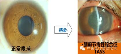 4dd395aa9ba34b1885ceca4b8964bc61.jpeg