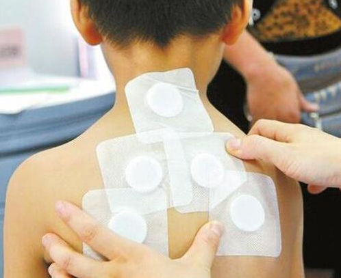                     原创            三伏贴也有副作用！这些三伏贴的使用注意事项你一定要清楚！