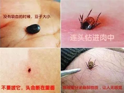                     3岁男孩被虫咬后器官衰竭，妈妈们认准这五种虫子！