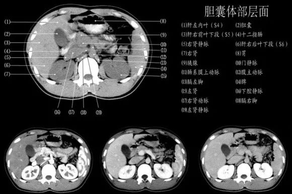 【干货满满】443例实例教你解读腹部ct!