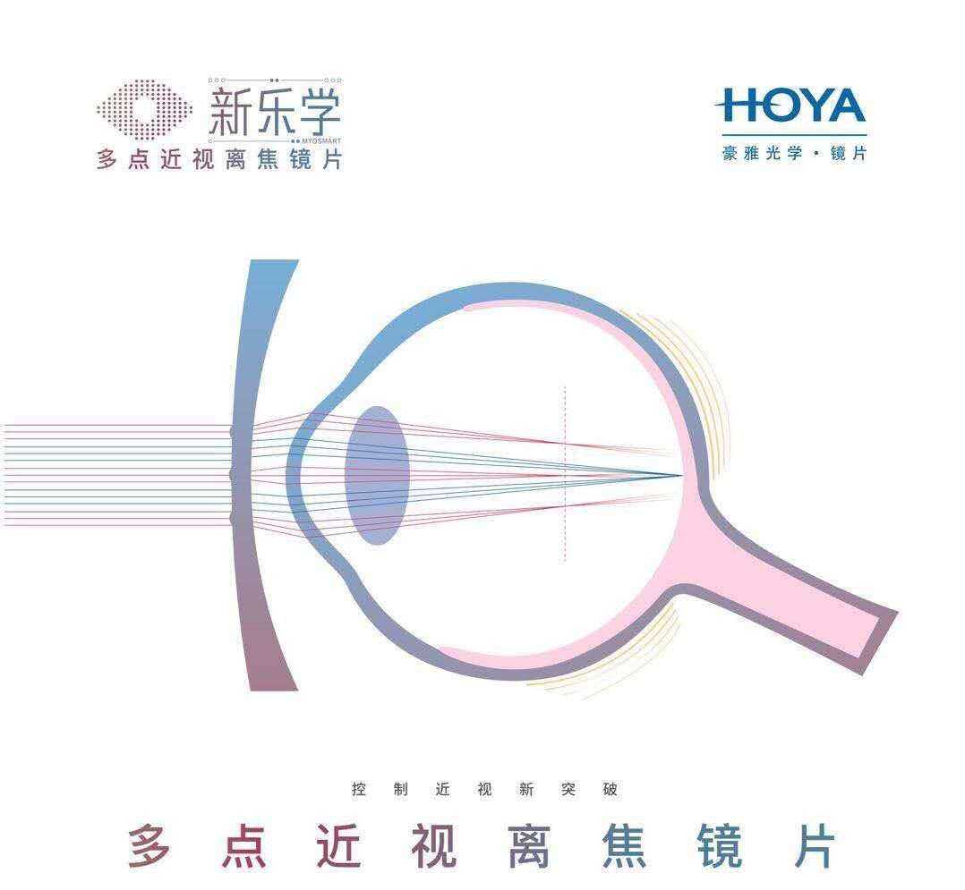 自己怎么测瞳距更准确 bfc32a6d6bb54f85b6acd3949f988be4.jpeg