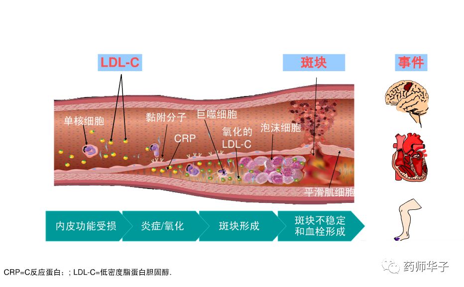 低密度脂蛋白胆固醇,高到什么程度要吃药呢,这篇文章讲明白了