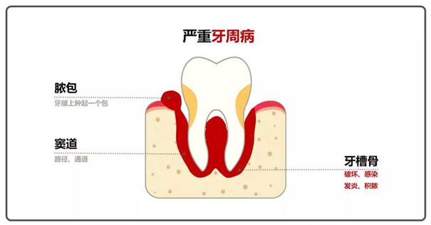 长了脓包怎么办