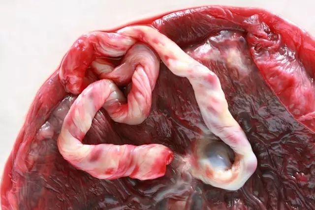                     新生儿一周进了两次ICU，竟因妈妈吃了这个东西！