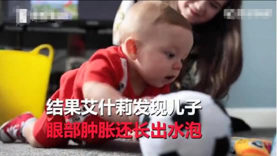                     原创            小宝宝被人亲了一下，不久后差点失明，住院两个半月才康复