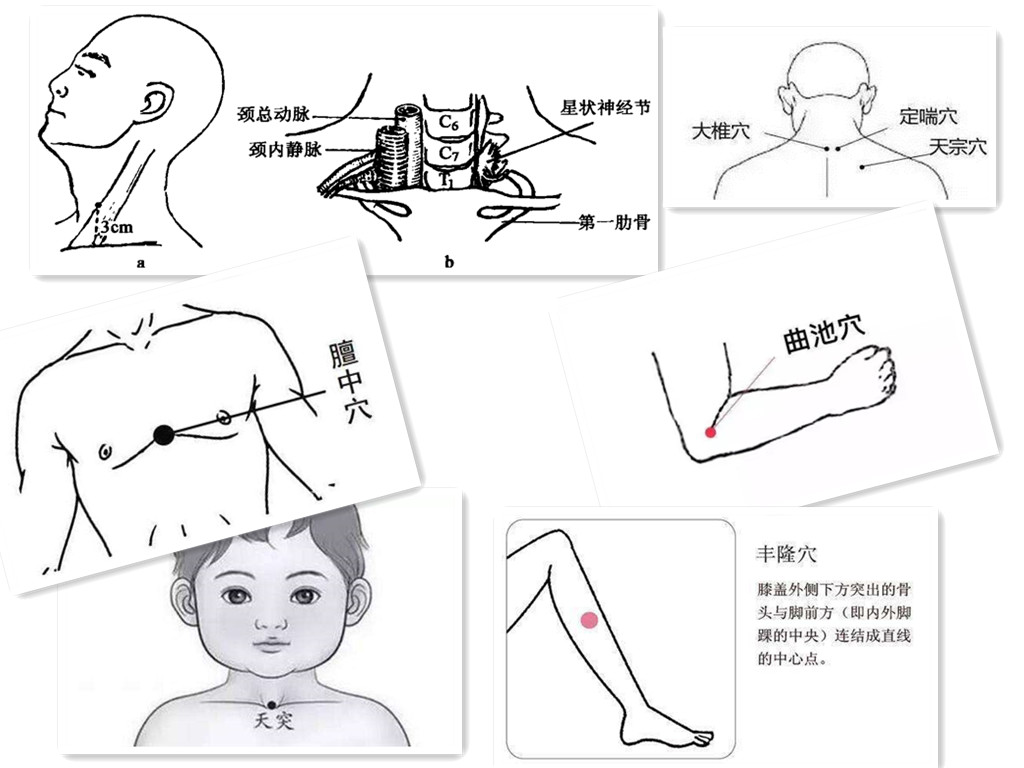 方法二: 下针之前找到天突,丰隆,厥阴俞,膏肓,中府,云门,血海这七个