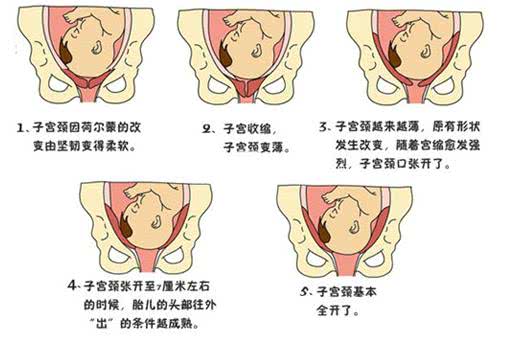 分娩过程中所说的骨缝开几指到底是什么意思?