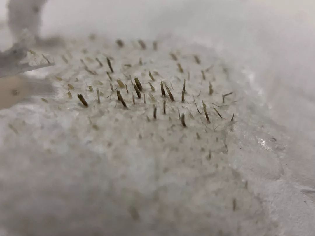 别再挤黑头了!一贴一撕,陈年黑头连根拔起,毛孔