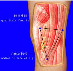 2,膝关节内侧方肌筋膜立体三角区:主要由股薄肌,缝匠肌与内侧副韧带