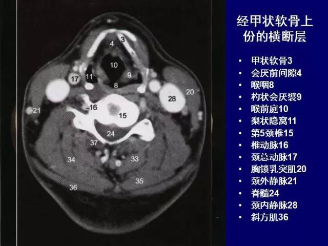 必点收藏 | 高清版颈部断层解剖