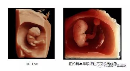 龙泉市中医医院医讯│三维彩超让您见证宝宝的精彩瞬间!