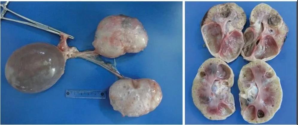 剖检照片:7岁雄性英国短毛猫多囊肾的横截面,检测pkd1基因突变阳性