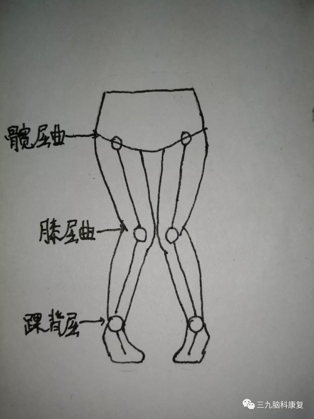 一文读懂儿童蹲伏步态及其训练方法