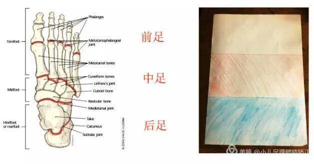 足弓浅怎么办