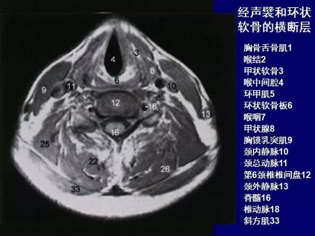 必点收藏高清版颈部断层解剖