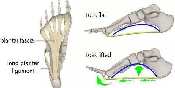 足弓浅怎么办