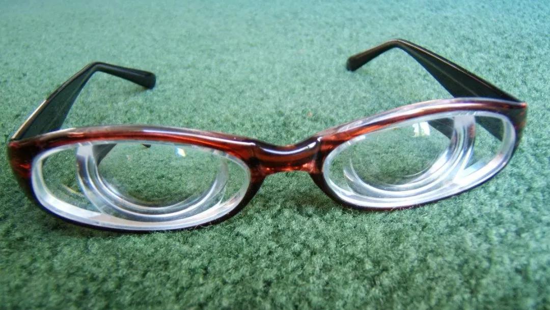 高度近视患者佩戴的眼镜"厚如瓶底"