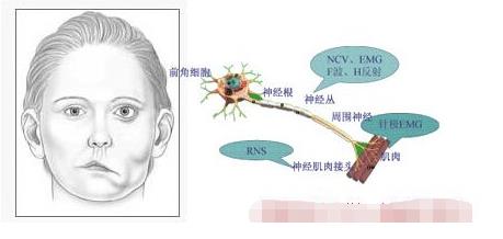 脸上肌肉跳动怎么办