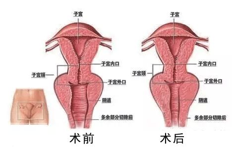 艺星私密整形你更紧一点,ta的爱更近一点