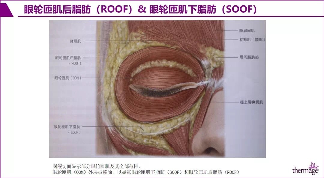 thermage眼部专项治疗(眶部解剖基础) (转载)_眼睑