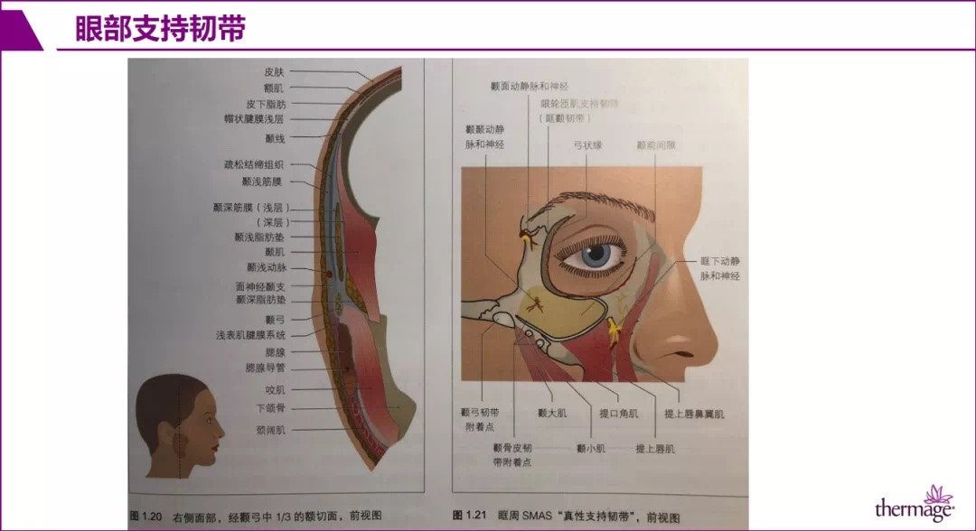 面部支持韧带作为浅表肌腱膜系统(smas)和真皮与深筋膜和骨膜的锚定点