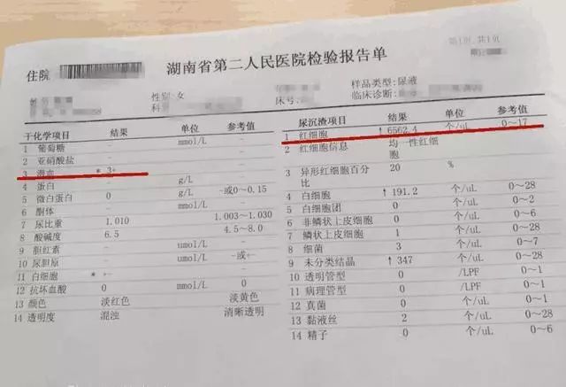                    只因为孕期少喝了这个，她疼得尿血！
