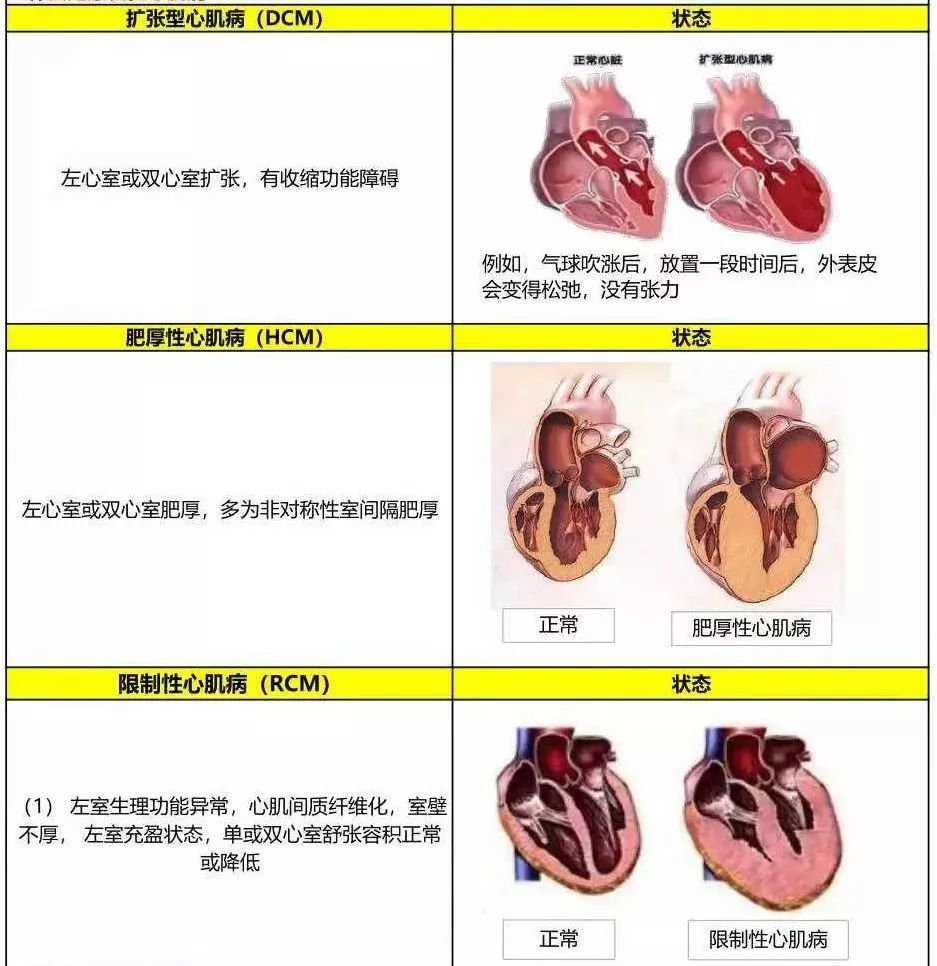 重疾条款解读(4)"严重原发性肺动脉高压"及"严重肺源性心脏病"(肺心病