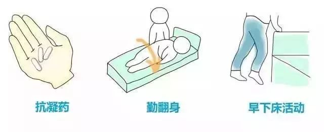 警惕孕期杀手下肢深静脉血栓