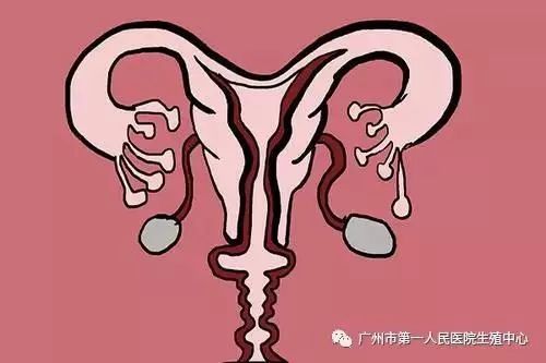 卵巢功能 伤害卵巢功能的因素，你中了几个？
