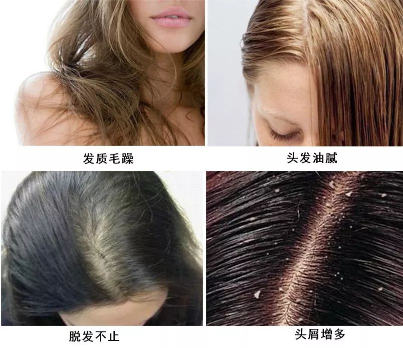 当头发出现这5种情况的时候，说明你该换洗发水了~:头发