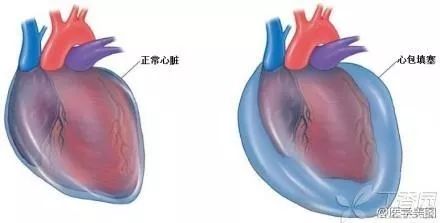 安远一3岁小孩遇车祸,心脏破裂,幸好.