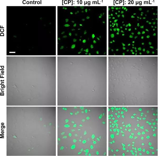 图四,不同浓度cp纳米点照射4 h后,dcfh-da染色u87mg癌细胞的荧光图像