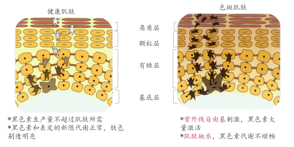 引发斑点的共通因素:黑色素——麦拉宁