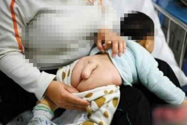 5个月男宝脚长 6个月的男宝竟然长出“小尾巴”，医院检查后，医生骂宝妈无知