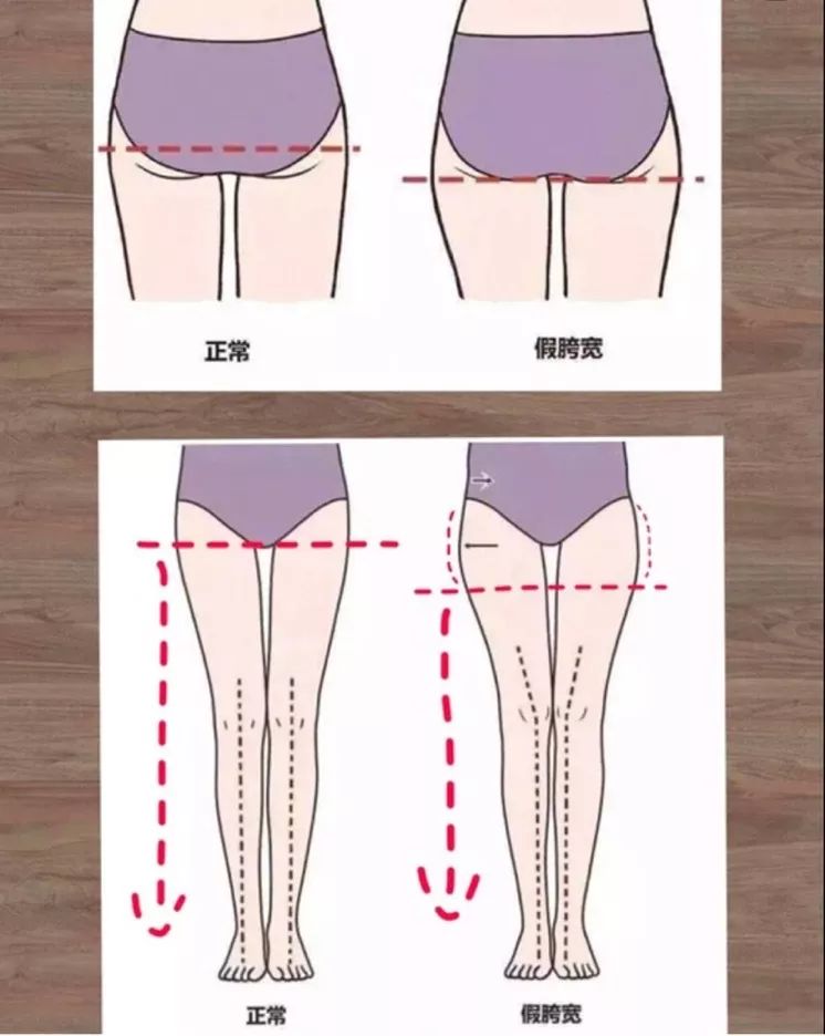 超模刘雯竟然是xo型腿?满满干货教你如何改善腿形,消灭假胯宽!