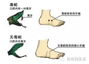 孕妇梦到把蛇赶走了,寓意与解析 孕妇梦到把蛇赶走了,寓意与解析