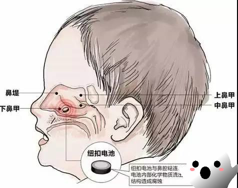                     小女孩突然吐血，全身变蓝！检查结果震惊所有父母