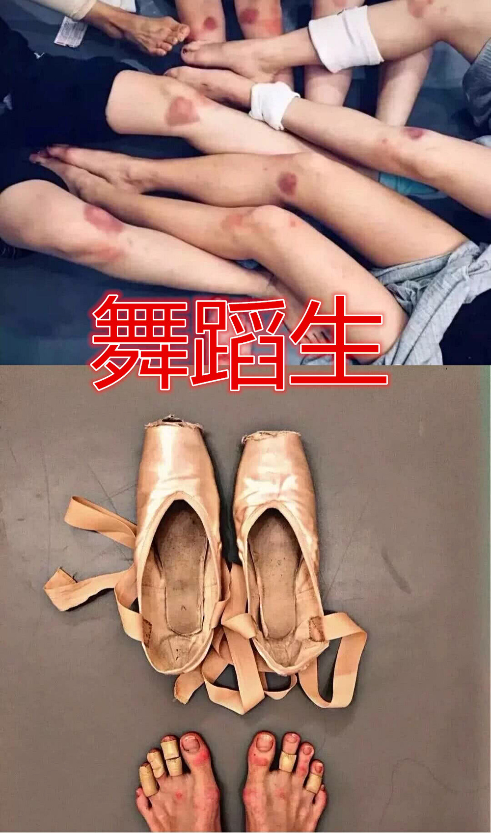 同样是炫脚舞蹈生受伤美术生很脏看到图5是有多金贵