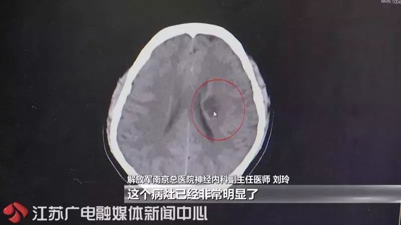 急性什么成语_成语故事简笔画(3)