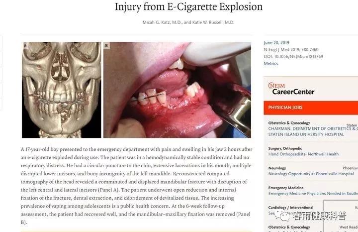 电子烟的危害 电子烟在口中爆炸：这2个电子烟隐患你必须知道！