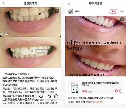 意大利牙人口_意大利人口分布图(2)