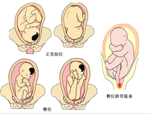 既想顺产，又想不疼，有这几种情况，恭喜你，产程会非常顺利