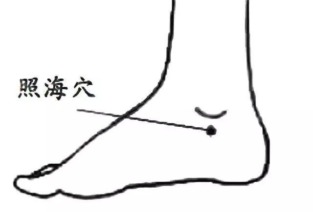 照海最早见于《针灸甲乙经》,《千金要方》称"漏阴",属足少阴肾经,是