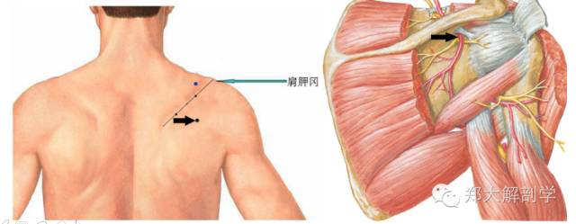 腋神经易卡压部位:四边孔 上界:小圆肌,肩胛骨外缘,肩胛下肌,肩关节