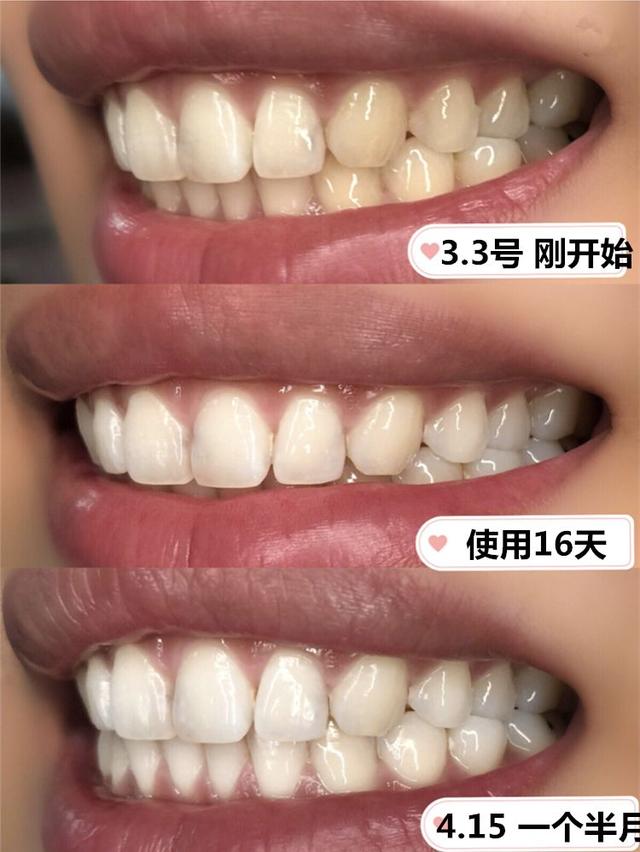 意大利牙人口_意大利人口分布图(2)