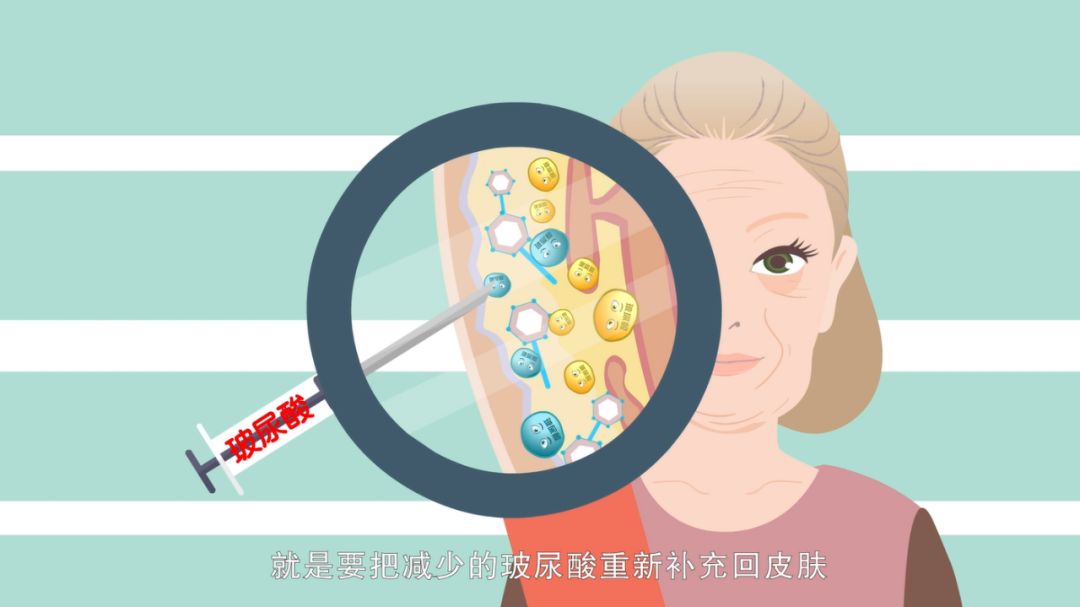 【温馨提示】注射玻尿酸真的会"一针变美"吗?