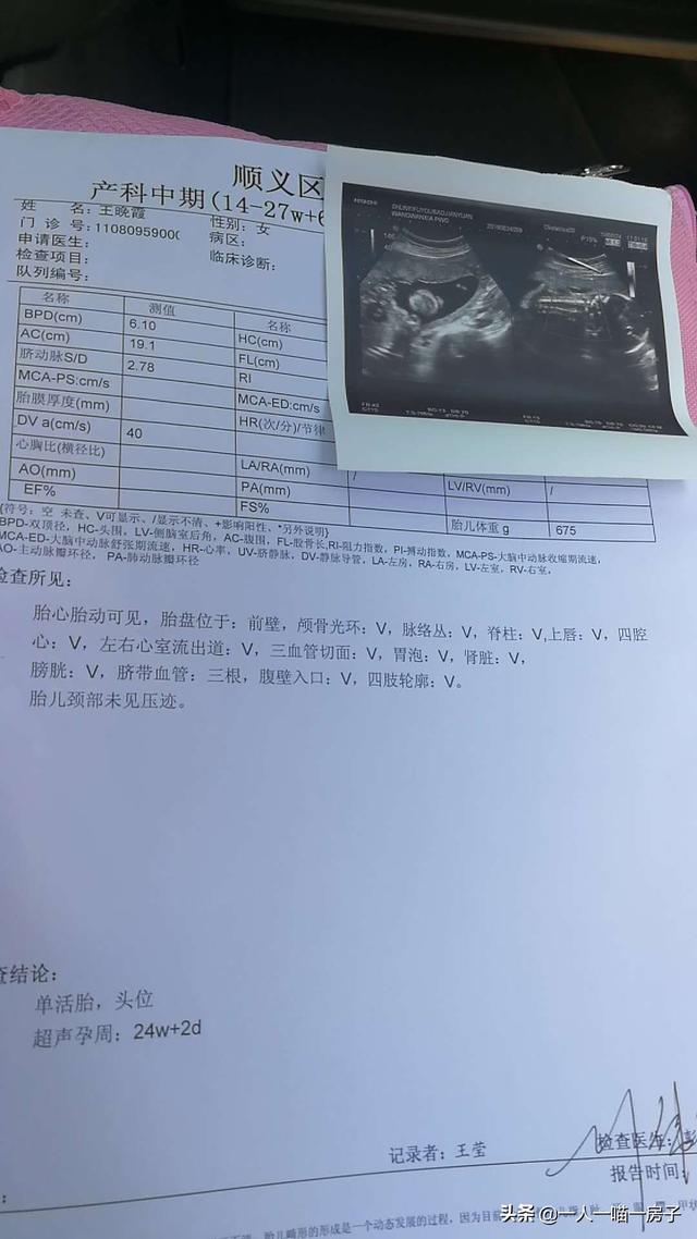 孕24周产筛顺利通过怀孕产检就像升级打怪兽