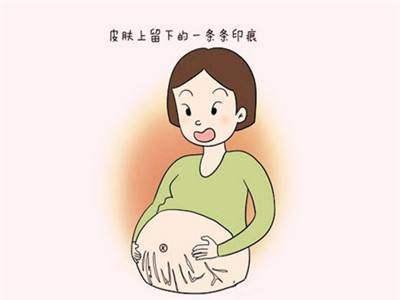 肚皮纹身妊娠纹_只要妊娠不要“纹”，是每个妈妈追求的目标