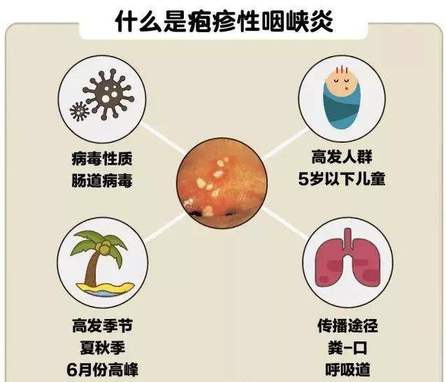 10个发烧宝宝,4个这种病!_咽峡炎