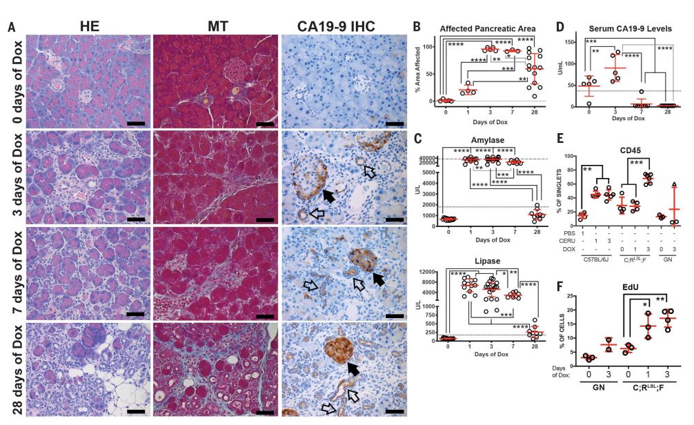 震惊science冷泉港发现ca199才是胰腺癌的幕后玩家